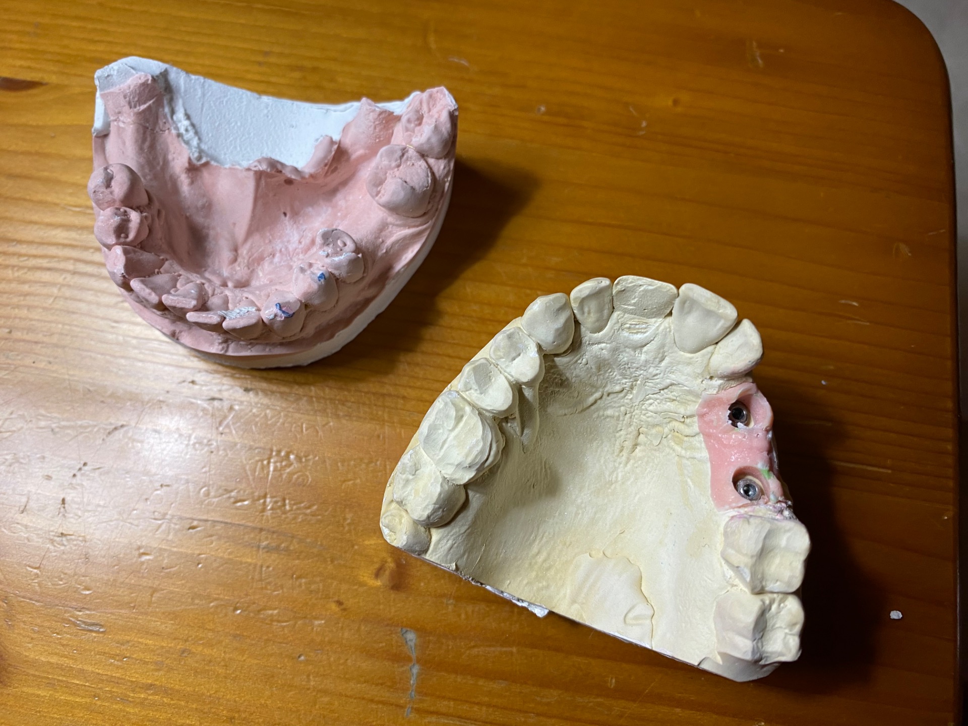 En la foto, el 3D que me realizaron en la clínica dental